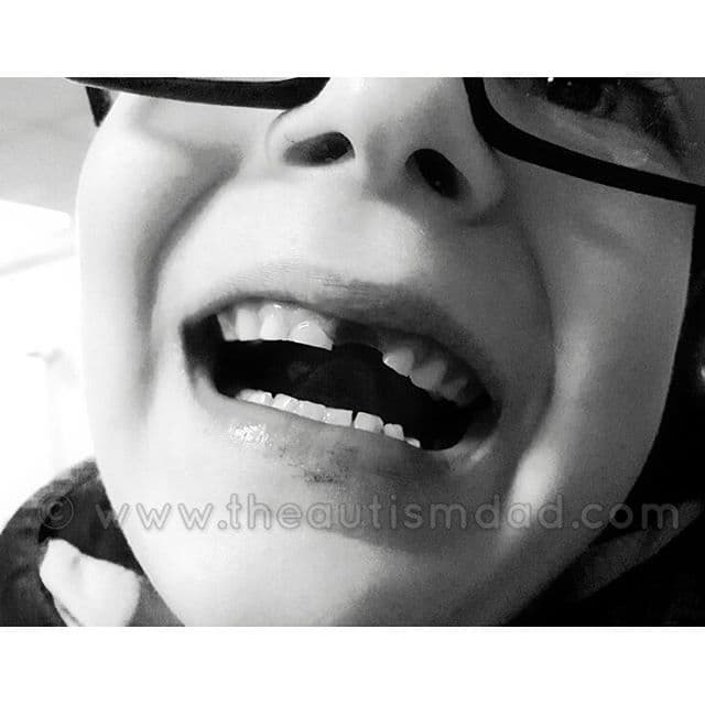 My tiny little Emmett lost his very first tooth today