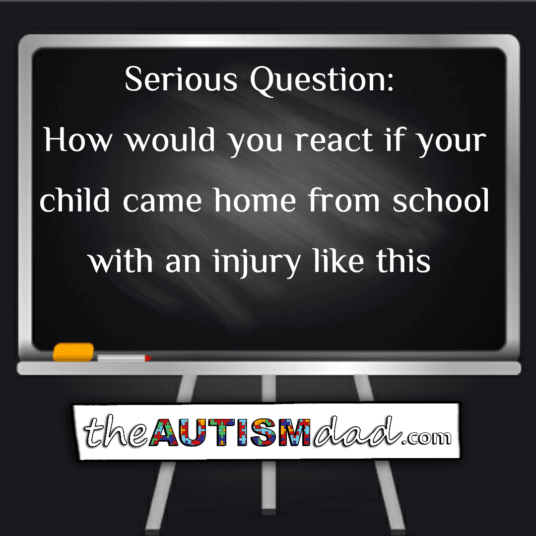 Serious Question: How would you react if your child came home from school with an injury like this